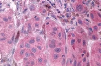 Anti-PTGFR antibody used in IHC (Paraffin sections) (IHC-P). GTX71101