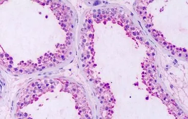 Anti-GPRC5A antibody used in IHC (Paraffin sections) (IHC-P). GTX71141