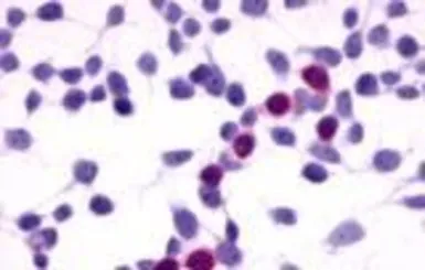Anti-GPRC5A antibody used in Immunocytochemistry/ Immunofluorescence (ICC/IF). GTX71141