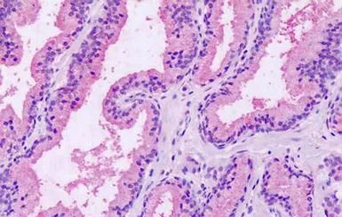 Anti-GPRC5A antibody used in IHC (Paraffin sections) (IHC-P). GTX71141