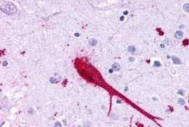 Anti-GPR37 antibody used in IHC (Paraffin sections) (IHC-P). GTX71159