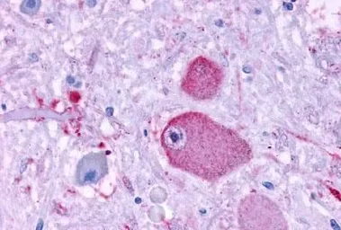 Anti-GPR37 antibody used in IHC (Paraffin sections) (IHC-P). GTX71159