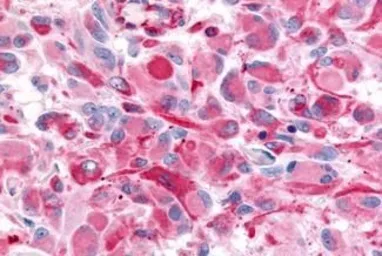 Anti-mAChR M2 antibody used in IHC (Paraffin sections) (IHC-P). GTX71169