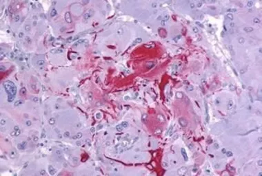 Anti-GPR105 antibody used in IHC (Paraffin sections) (IHC-P). GTX71177