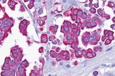 Anti-GPR105 antibody used in IHC (Paraffin sections) (IHC-P). GTX71177