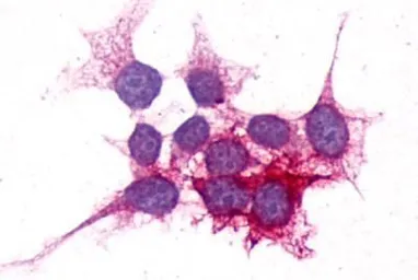 Anti-GPR105 antibody used in Immunocytochemistry/ Immunofluorescence (ICC/IF). GTX71177