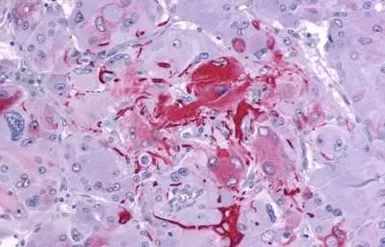 Anti-GPR105 antibody used in IHC (Paraffin sections) (IHC-P). GTX71177