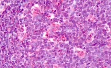 Anti-Latrophilin 3 antibody used in IHC (Paraffin sections) (IHC-P). GTX71183