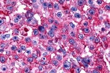 Anti-GPR175 antibody used in IHC (Paraffin sections) (IHC-P). GTX71185