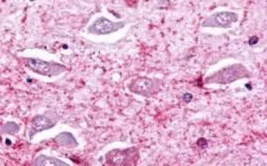 Anti-GPR175 antibody used in IHC (Paraffin sections) (IHC-P). GTX71185