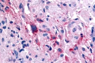 Anti-GPR32 antibody used in IHC (Paraffin sections) (IHC-P). GTX71225