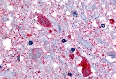 Anti-GPR32 antibody used in IHC (Paraffin sections) (IHC-P). GTX71225