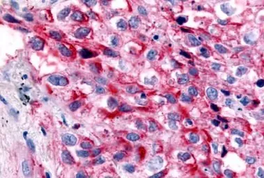 Anti-GPR32 antibody used in IHC (Paraffin sections) (IHC-P). GTX71225