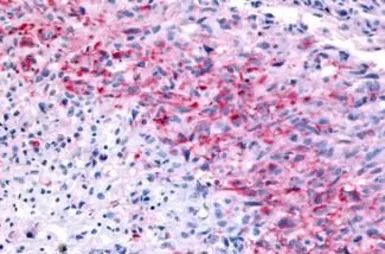 Anti-GPR32 antibody used in IHC (Paraffin sections) (IHC-P). GTX71225
