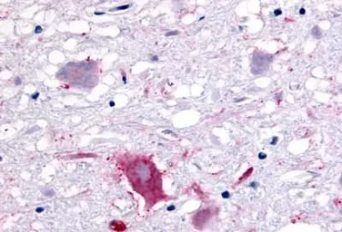 Anti-GPR32 antibody used in IHC (Paraffin sections) (IHC-P). GTX71225