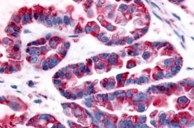 Anti-GPR32 antibody used in IHC (Paraffin sections) (IHC-P). GTX71225
