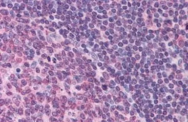 Anti-FPR1 antibody used in IHC (Paraffin sections) (IHC-P). GTX71285