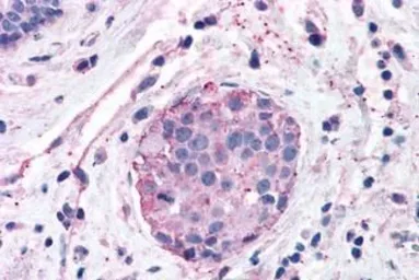 Anti-XPR1 antibody used in IHC (Paraffin sections) (IHC-P). GTX71325