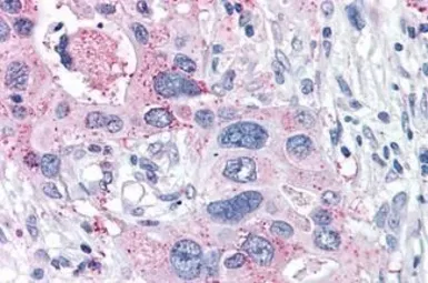 Anti-XPR1 antibody used in IHC (Paraffin sections) (IHC-P). GTX71325