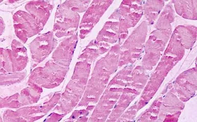 Anti-XPR1 antibody used in IHC (Paraffin sections) (IHC-P). GTX71325
