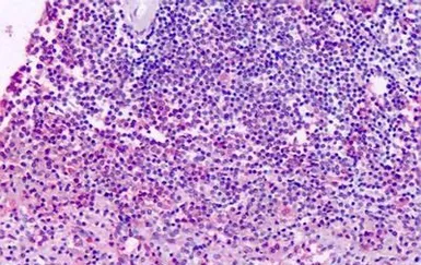 Anti-XPR1 antibody used in IHC (Paraffin sections) (IHC-P). GTX71325