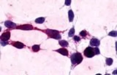 Anti-XPR1 antibody used in Immunocytochemistry/ Immunofluorescence (ICC/IF). GTX71325