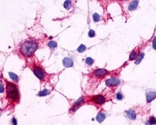 Anti-GPR44 antibody used in Immunocytochemistry/ Immunofluorescence (ICC/IF). GTX71385