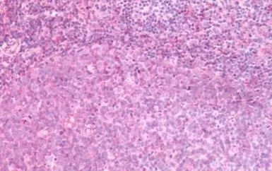 Anti-GPR44 antibody used in IHC (Paraffin sections) (IHC-P). GTX71385