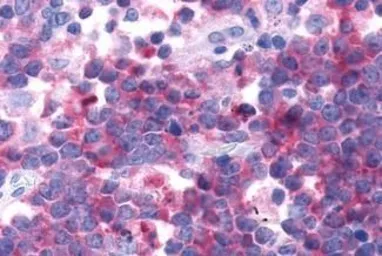 Anti-GPR44 antibody used in IHC (Paraffin sections) (IHC-P). GTX71385