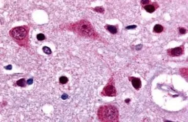 Anti-LGR4 antibody used in IHC (Paraffin sections) (IHC-P). GTX71401