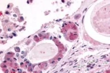 Anti-AVPR1B antibody used in IHC (Paraffin sections) (IHC-P). GTX71413