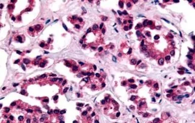 Anti-AVPR1B antibody used in IHC (Paraffin sections) (IHC-P). GTX71413