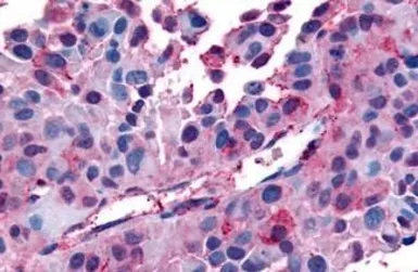 Anti-AVPR1B antibody used in IHC (Paraffin sections) (IHC-P). GTX71413