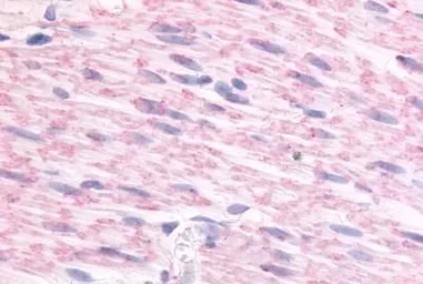 Anti-alpha 2c Adrenergic Receptor antibody used in IHC (Paraffin sections) (IHC-P). GTX71447