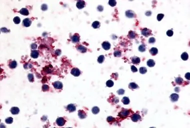 Anti-Prostaglandin I2 Receptor antibody used in IHC (Paraffin sections) (IHC-P). GTX71509