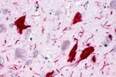 Anti-GPR78 antibody used in IHC (Paraffin sections) (IHC-P). GTX71513