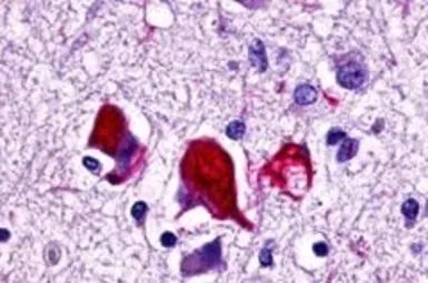 Anti-GPR78 antibody used in IHC (Paraffin sections) (IHC-P). GTX71513
