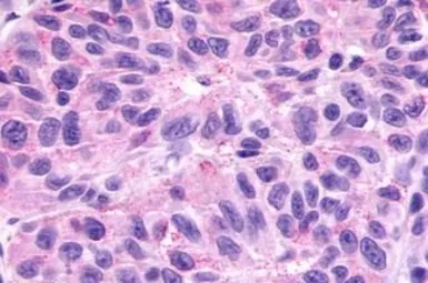 Anti-GPR78 antibody used in IHC (Paraffin sections) (IHC-P). GTX71513