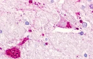 Anti-CMKLR1 antibody used in IHC (Paraffin sections) (IHC-P). GTX71519