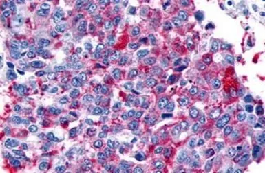 Anti-Frizzled 8 antibody used in IHC (Paraffin sections) (IHC-P). GTX71543