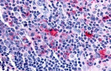 Anti-Frizzled 8 antibody used in IHC (Paraffin sections) (IHC-P). GTX71543