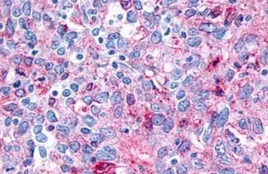 Anti-Frizzled 8 antibody used in IHC (Paraffin sections) (IHC-P). GTX71543