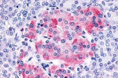 Anti-Frizzled 8 antibody used in IHC (Paraffin sections) (IHC-P). GTX71543