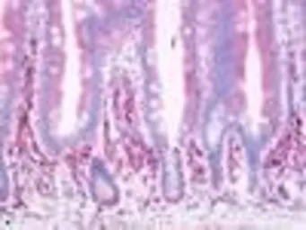 Anti-PTGDR antibody used in IHC (Paraffin sections) (IHC-P). GTX71571