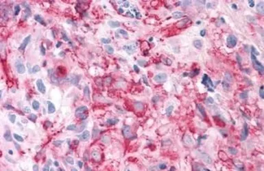 Anti-T1R3 antibody used in IHC (Paraffin sections) (IHC-P). GTX71575