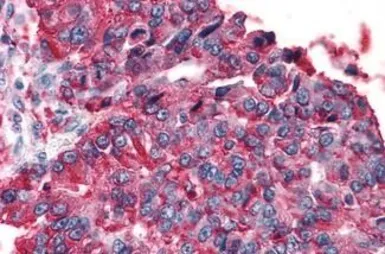 Anti-T1R3 antibody used in IHC (Paraffin sections) (IHC-P). GTX71575