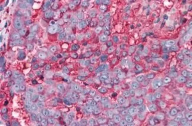 Anti-T1R3 antibody used in IHC (Paraffin sections) (IHC-P). GTX71575