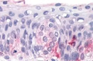 Anti-T1R3 antibody used in IHC (Paraffin sections) (IHC-P). GTX71575