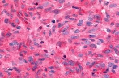 Anti-Frizzled 9 antibody used in IHC (Paraffin sections) (IHC-P). GTX71581