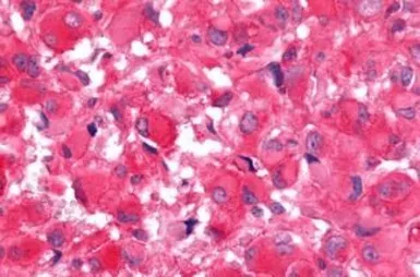Anti-Frizzled 9 antibody used in IHC (Paraffin sections) (IHC-P). GTX71581